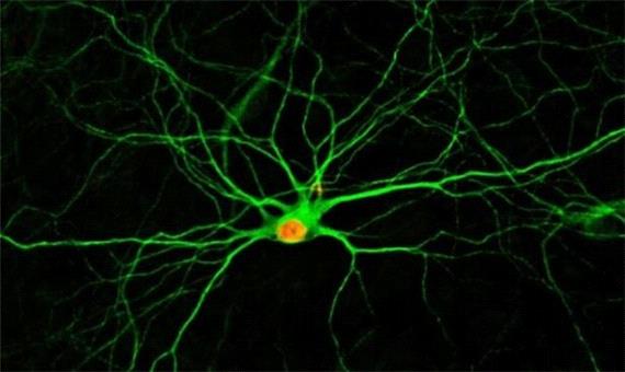 ساخت نرم‌افزار تشخیص آنلاین نورون‌های داخل قشر مغز در حیوان