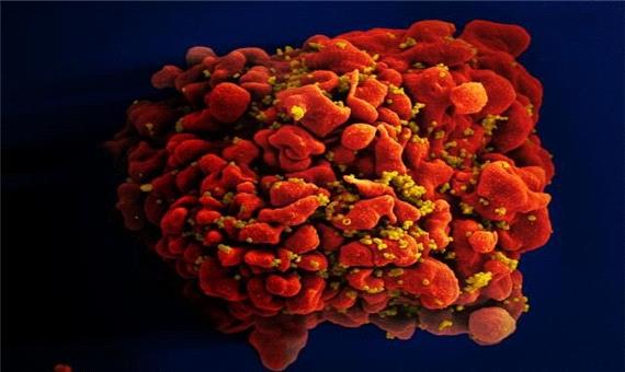 ژنوم ویروس ایدز در یک نمونه بافتی از سال 1966 یافت شد