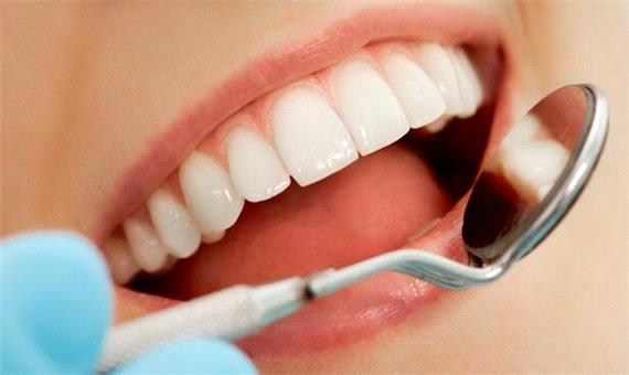 فناوری ساخت چسب دندان در داخل کشور فراهم شد