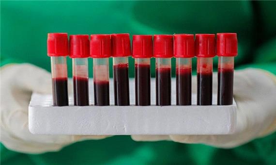 گروه خونی ممکن است خطر و شدت کووید 19 را تغییر دهد