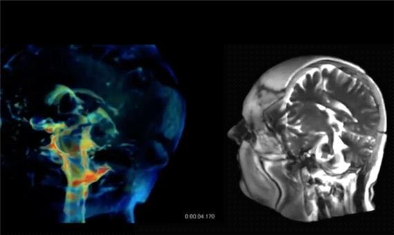 فناوری جدیدی برای تصویربرداری 3 بعدی از مغز