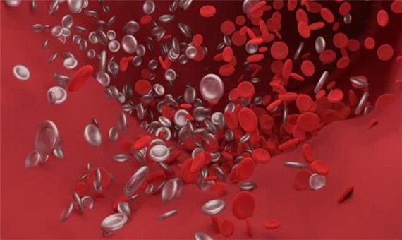 دلیل لخته شدن خون در بیماران کووید-19 چیست؟