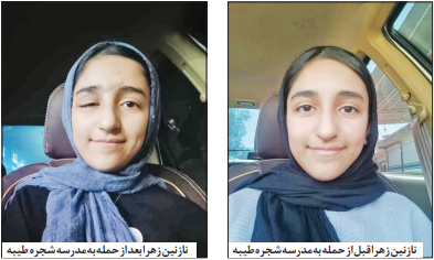 راه ترقی