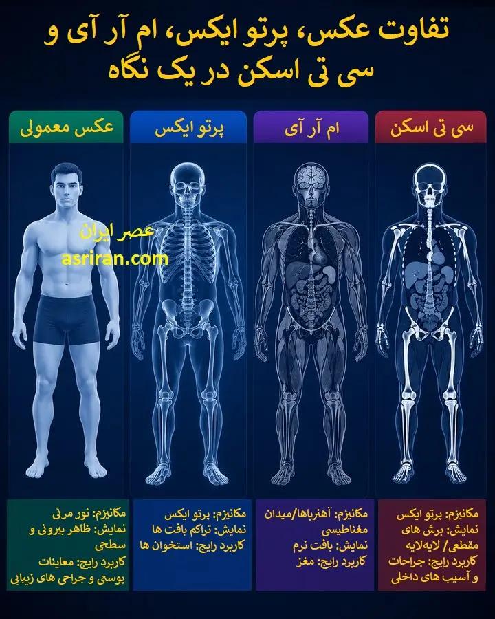 راه ترقی