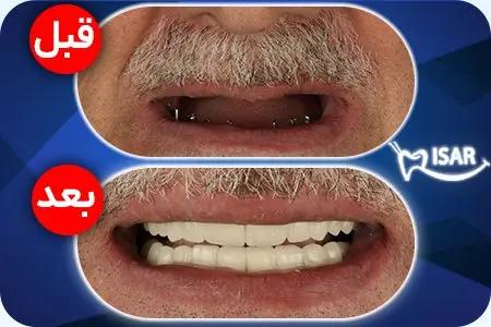 راه ترقی